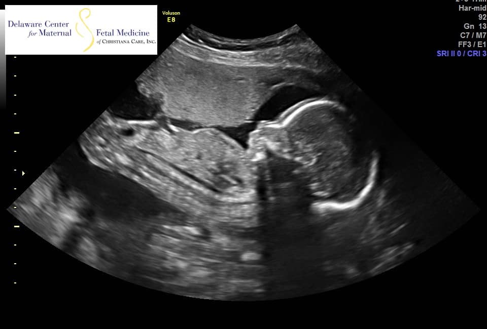 Thoughts of a Pregnant&nbsp;Lady